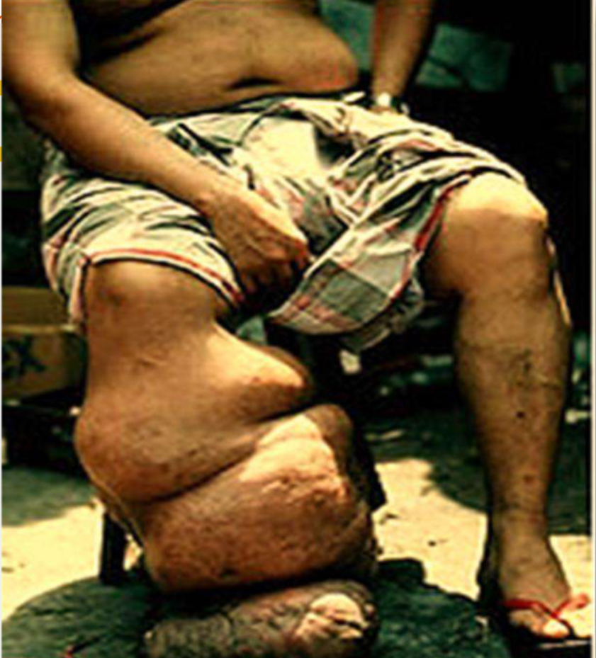 <p>Disease; caused by</p><p></p>