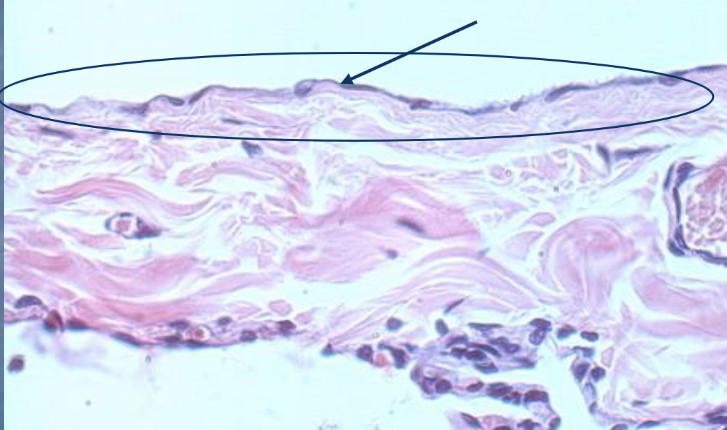 <p>What tissue type is this?</p>