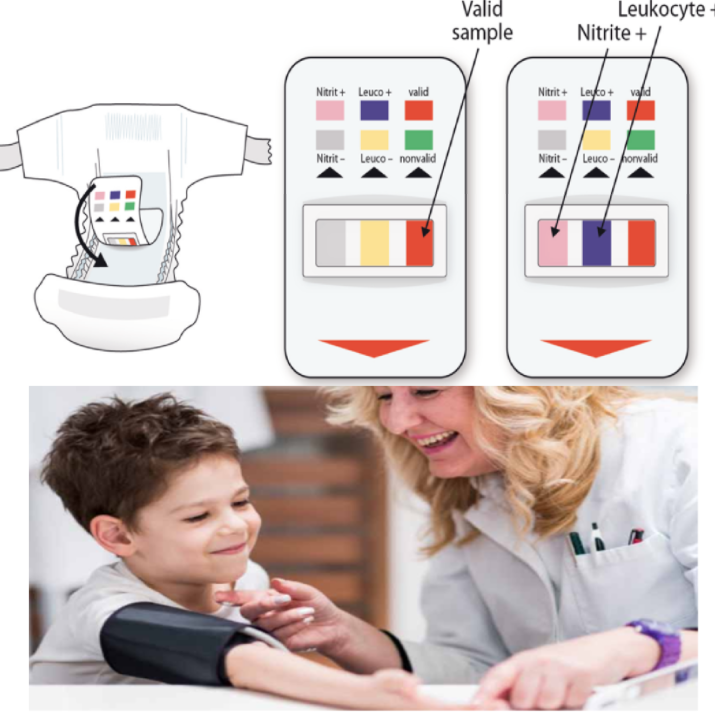 <ol><li><p>Urinalysis (from diapers) - detects byproducts of excess hormone production </p></li><li><p>Hypotension (high blood pressure)</p></li></ol><p></p>