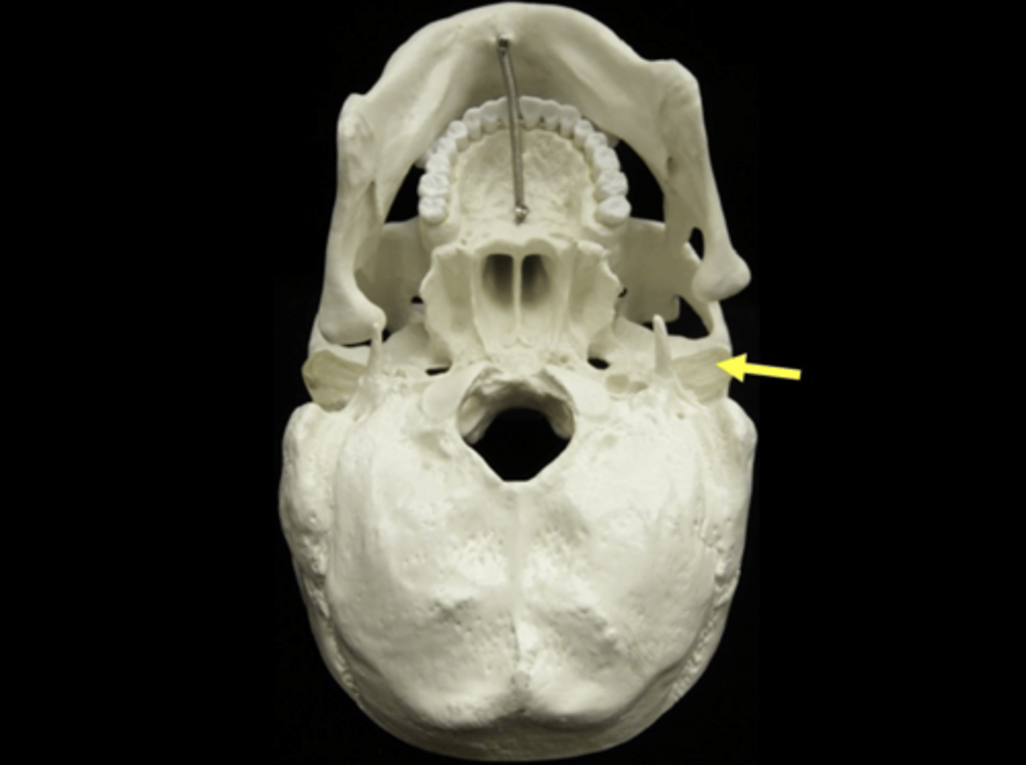 <p>name the bone and bone feature</p>