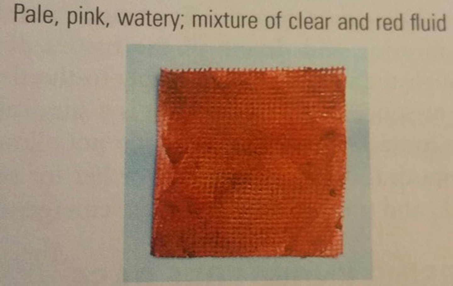 <p>serous exudate with some blood</p>