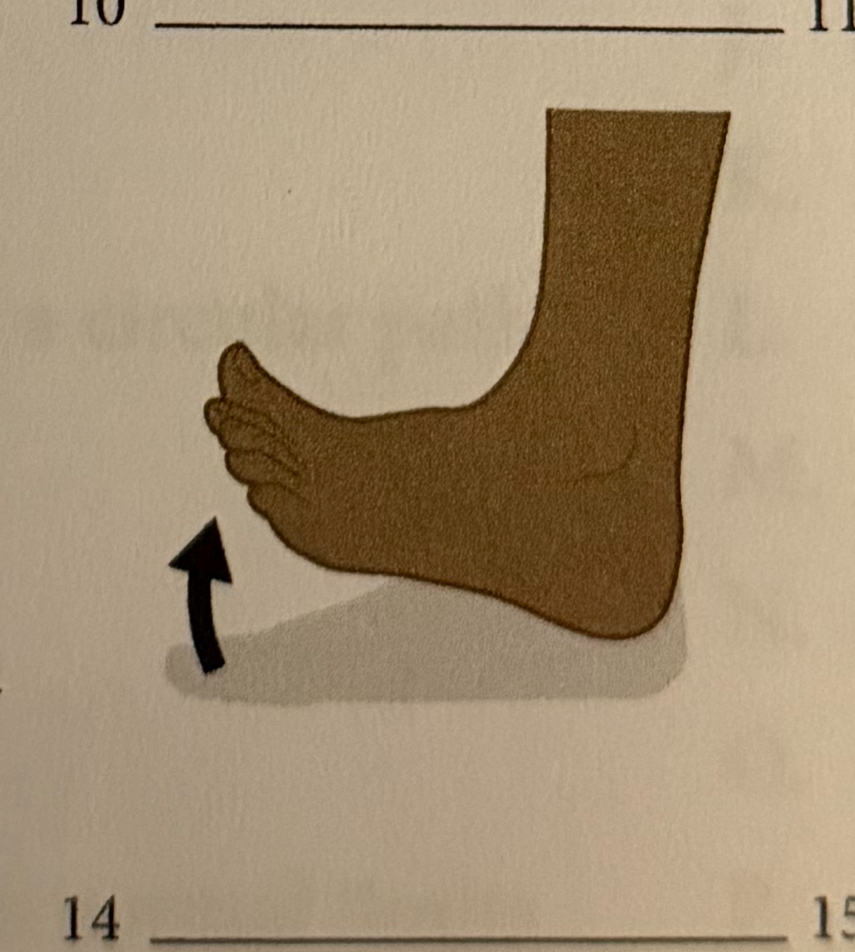 <p>extending the limb or joint beyond its normal limits</p>