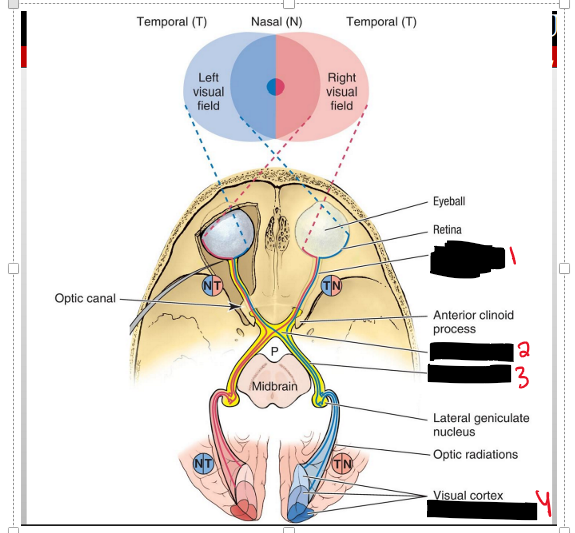 <p>You will receive the vision of the same side but It is going to cross to the opposite side into the optic chiasm- into the optic tract- into the occipital lobe</p>