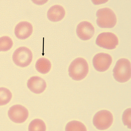 <p>What is the shape of this erythrocyte?</p>