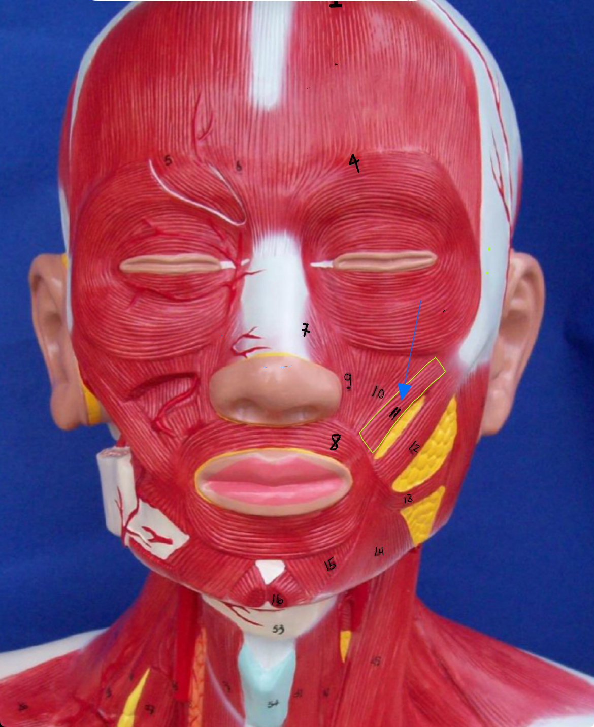 <p>what type of muscle is this (altay model)</p>