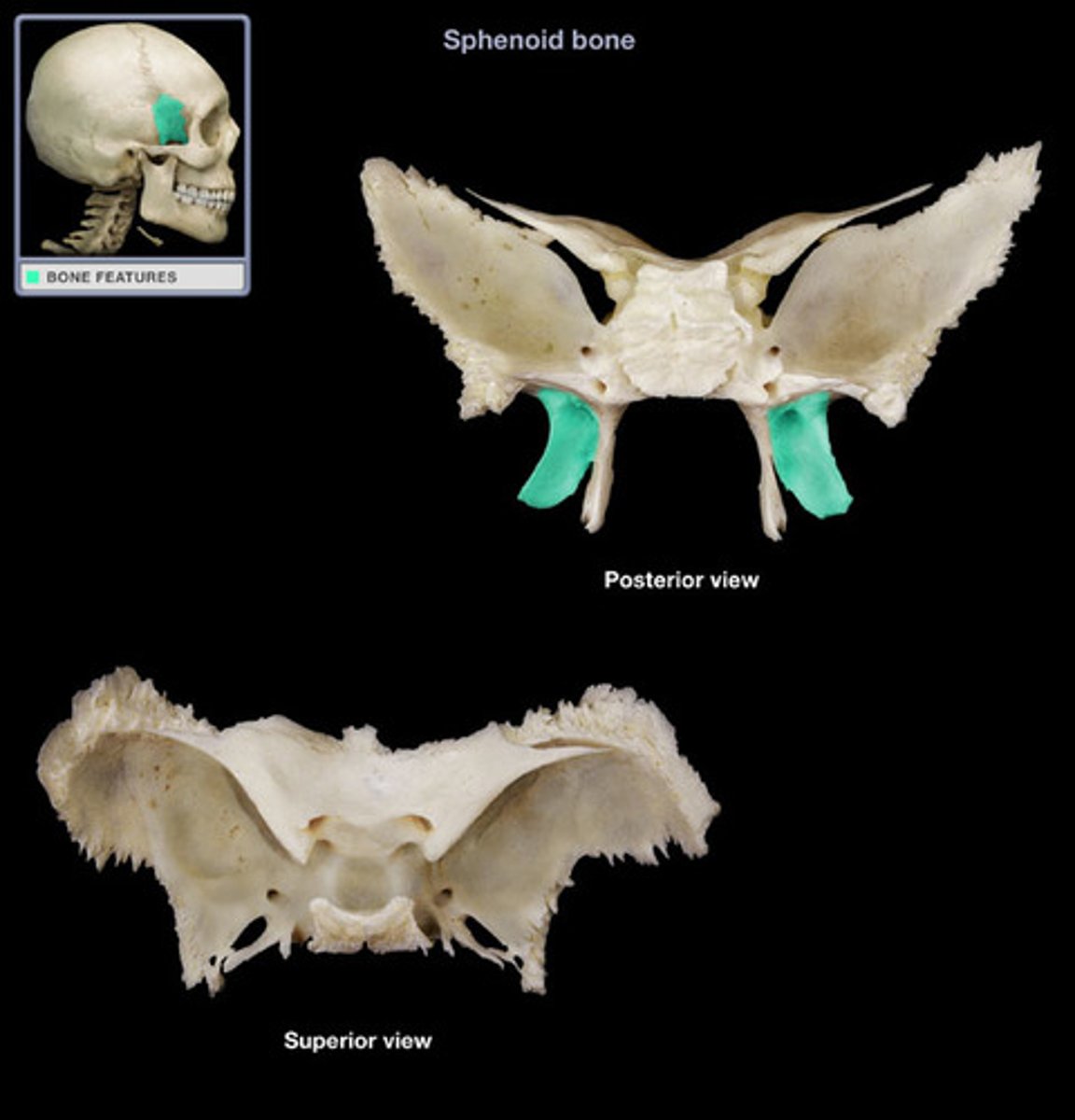 <p>Hamulus</p><p>Medial Pterygoid Plate</p><p>Lateral Pterygoid Plate</p>