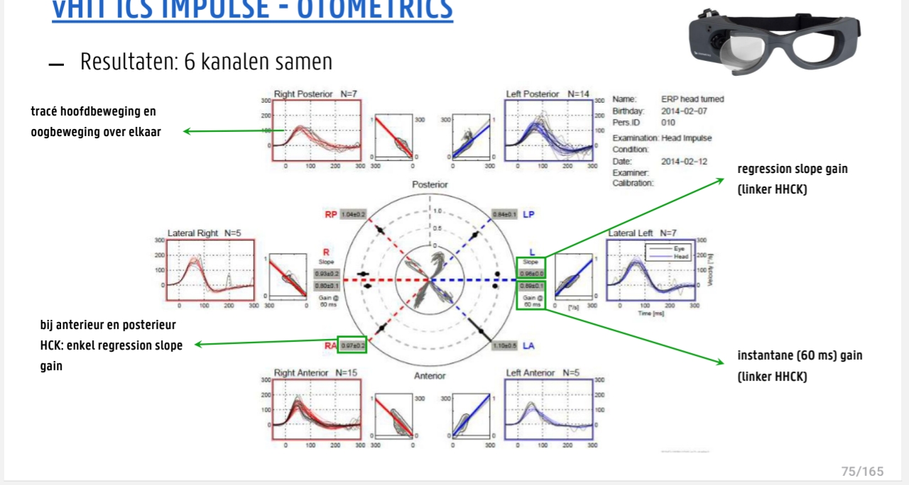<p>opgelet trace van oogbeweging 180° gedraait</p><p>rechthoekjes = gain</p>
