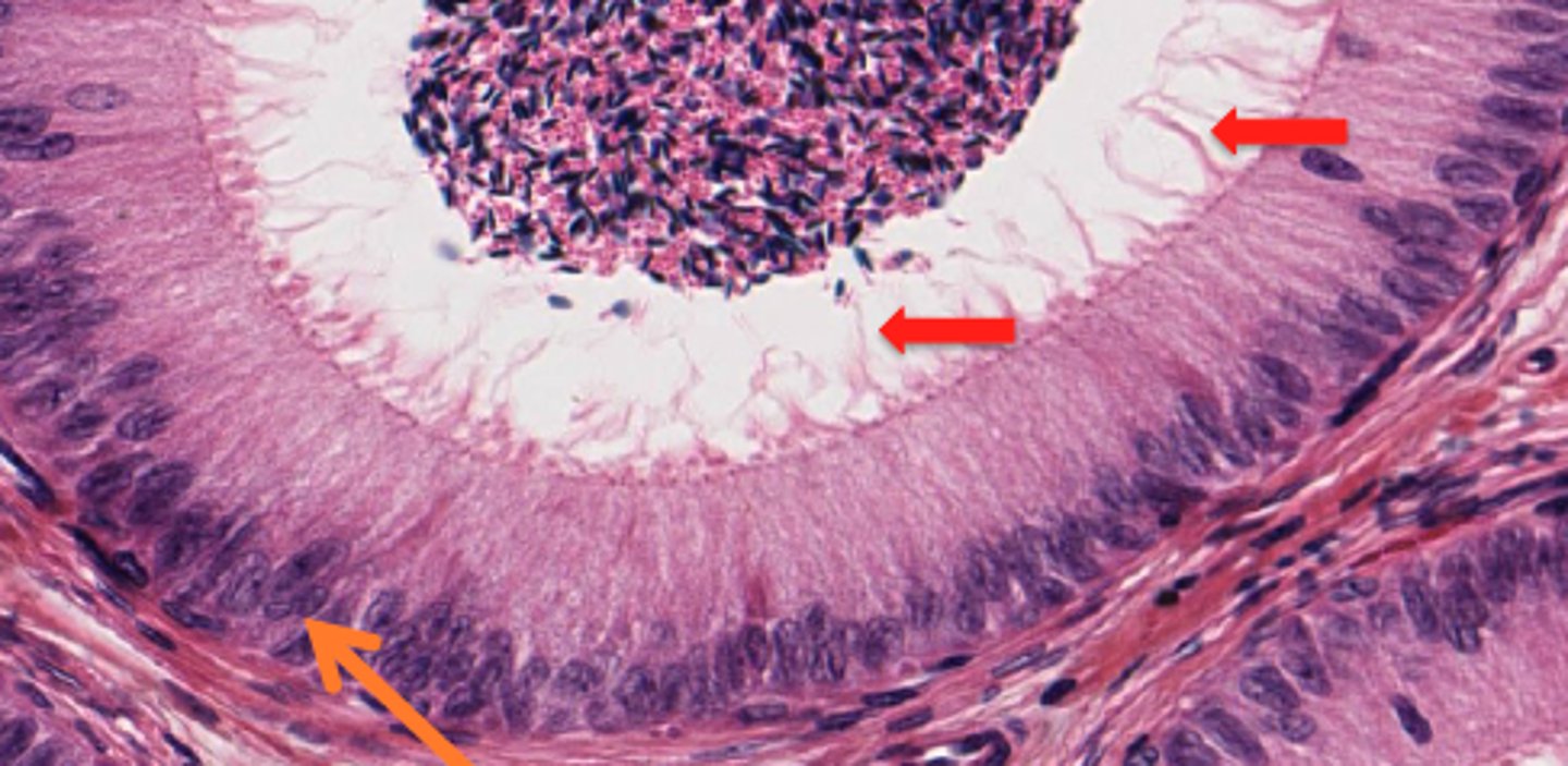 <p>Long extensions of the cell membrane; rare</p>