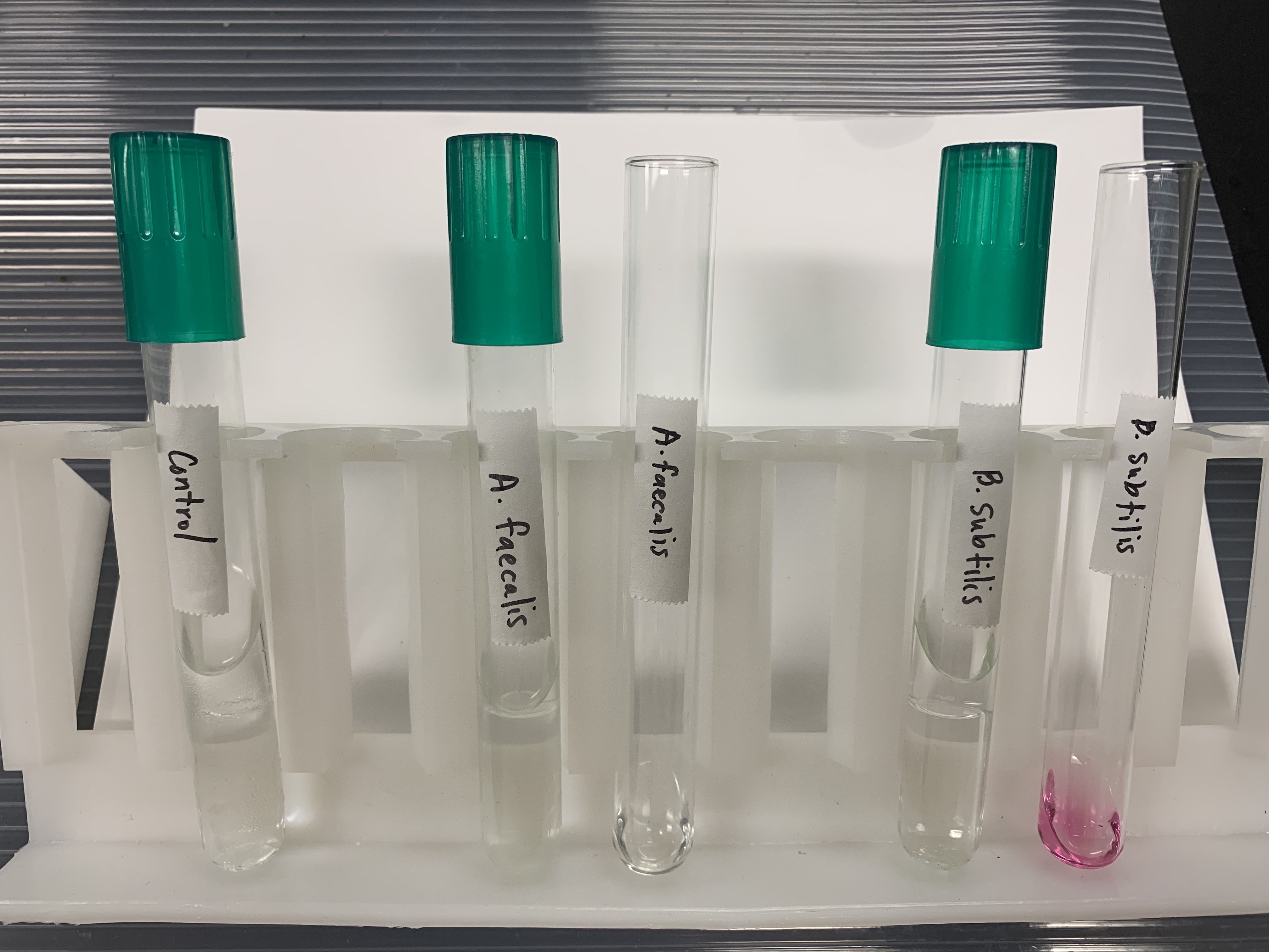 <p>What does a POSITVE and NEGATIVE test mean for Reduction of Nitrates? </p>