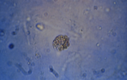 <p>Name this cell? What is it associated with?</p>