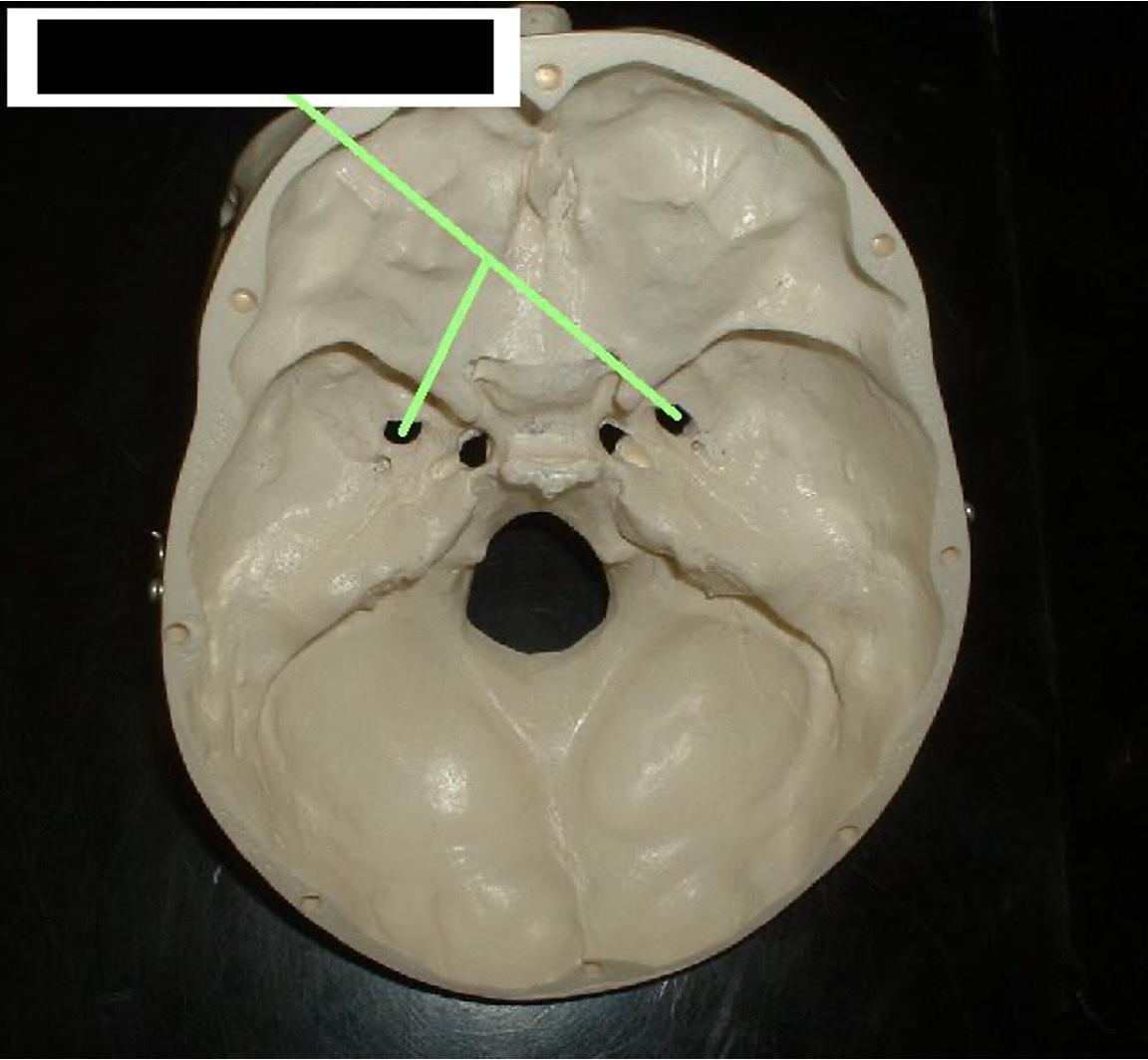 <p>Oval-shaped hole that is about an inch behind the foramen rotundum</p>