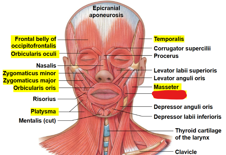 <p>What muscle is this?</p>