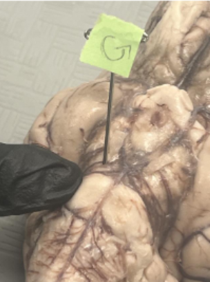 <p>What does letter G represent on the brain?</p>