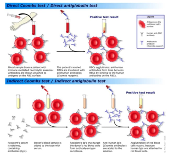 <p>detects IgG antibodies and complement proteins that have attached to red cells either in vitro or in vivo but do not produce visible agglutination</p>