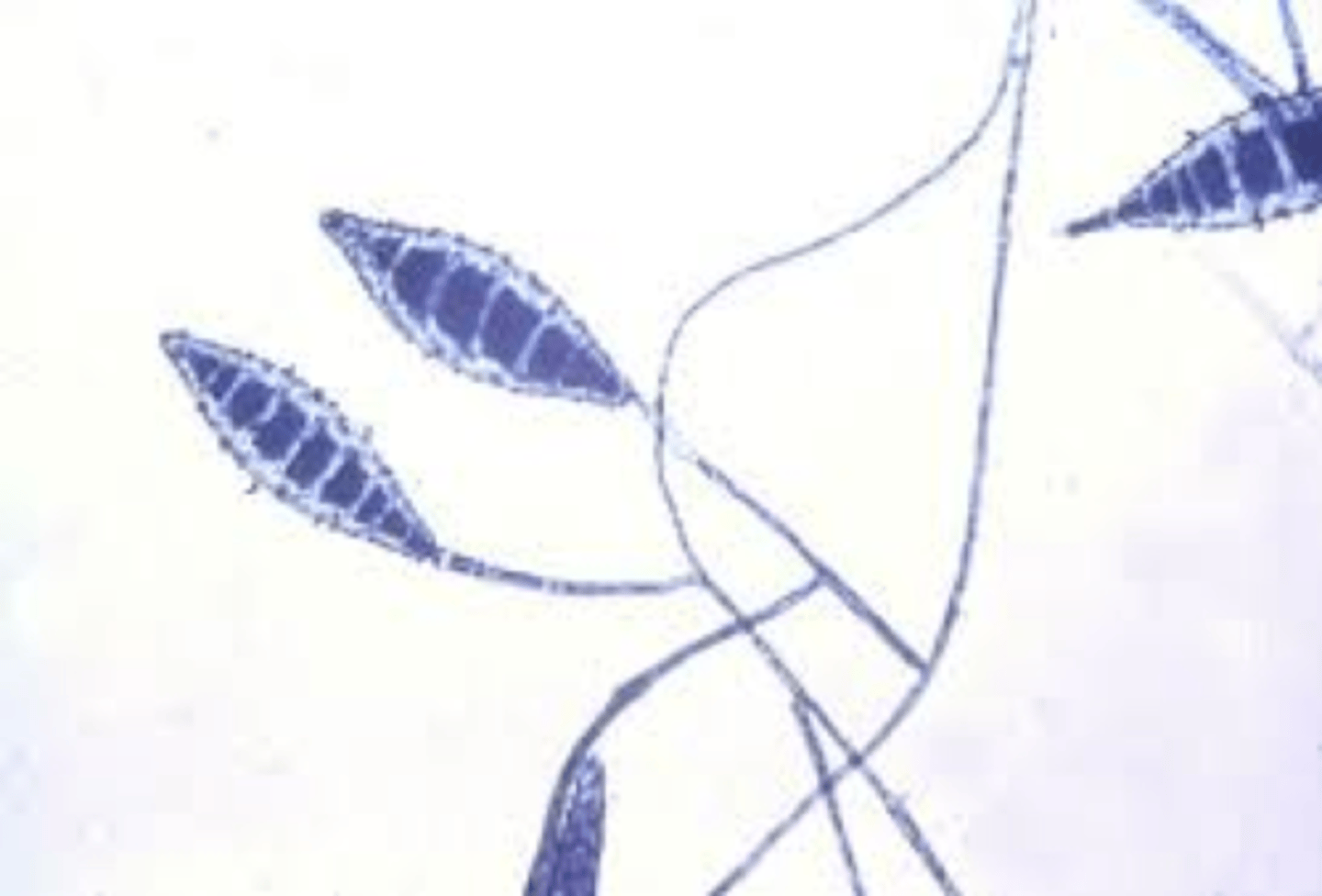 <p>Causes ringworm</p>
