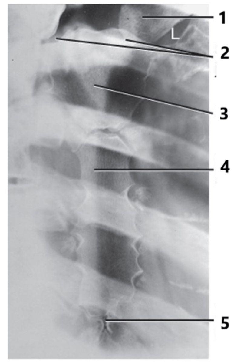 <p>Which structure is identified by the number 1?</p>