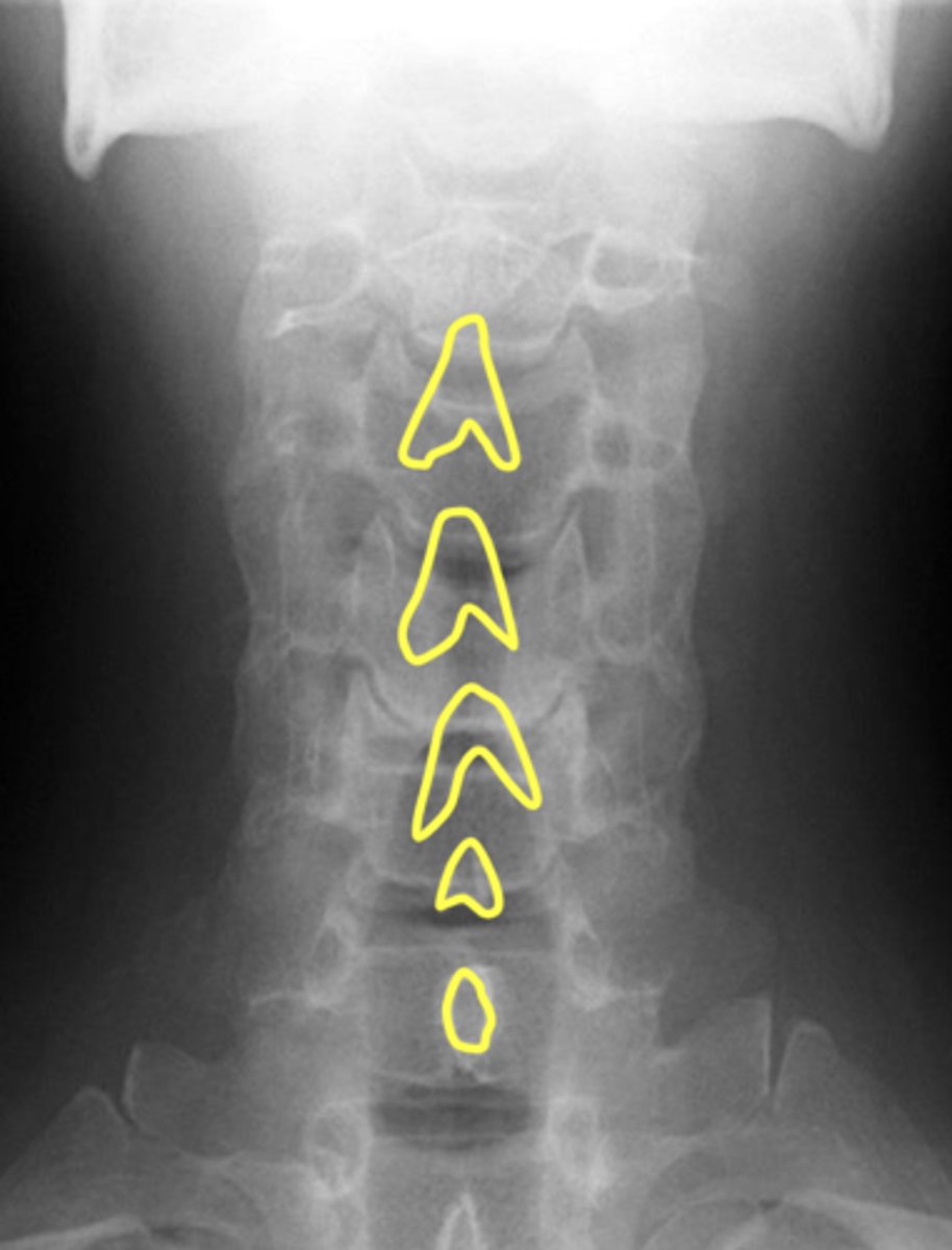 <p>What are outlined in yellow?</p>