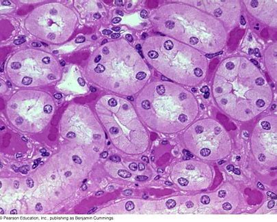 <p>what type of epithelial tissue is this?</p>