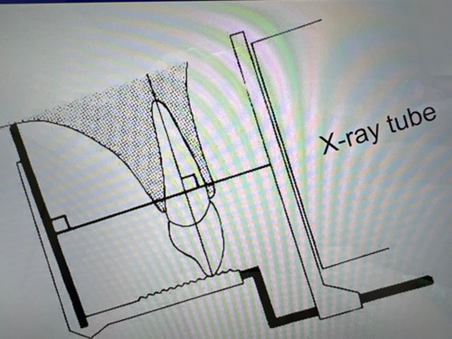 <p>• Sensor/film is placed into a beam aiming device</p><p>• This is positioned in the mouth so sensor/film is parallel to the long axis of tooth.</p><p>• X-ray tube is angled perpendicular to the sensor.</p>