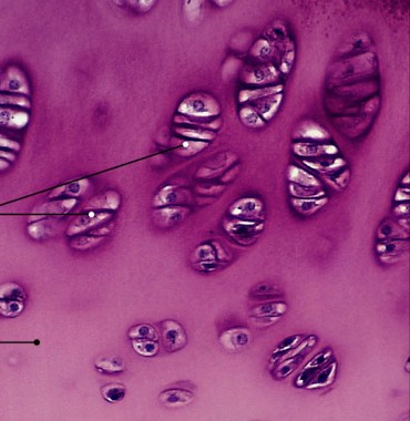 <p>Which type of cartilage has:</p><ul><li><p>Translucent matrix, extremely fine collagenous fibers, no prominent fibers</p></li><li><p>Reduces friction in joints &amp; between bones</p></li><li><p>Found in synovial joints &amp; on rib tips</p></li></ul><p></p>