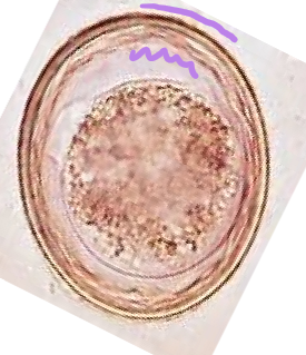 <p>Smooth outer shell with ruffled inner membrane</p>