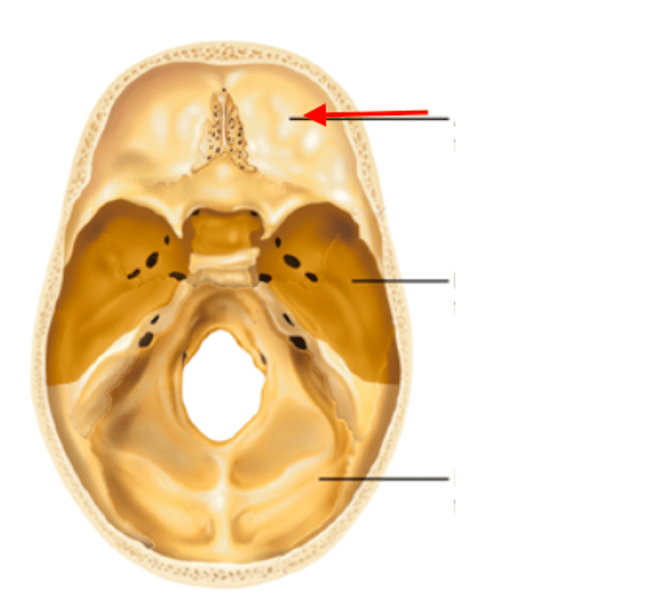 <p>primary frontal bone</p>