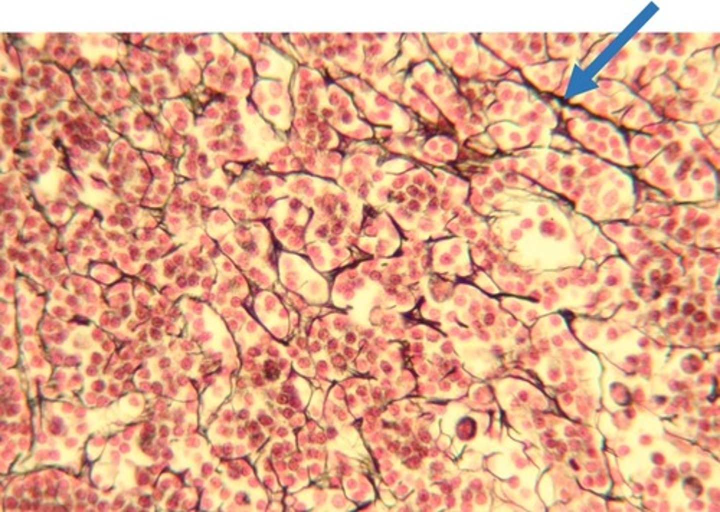 <p>Fibers made of collagen fibers that are very thin and branched. Form a tightly woven fabric that joins connective tissue to adjacent tissues.</p>