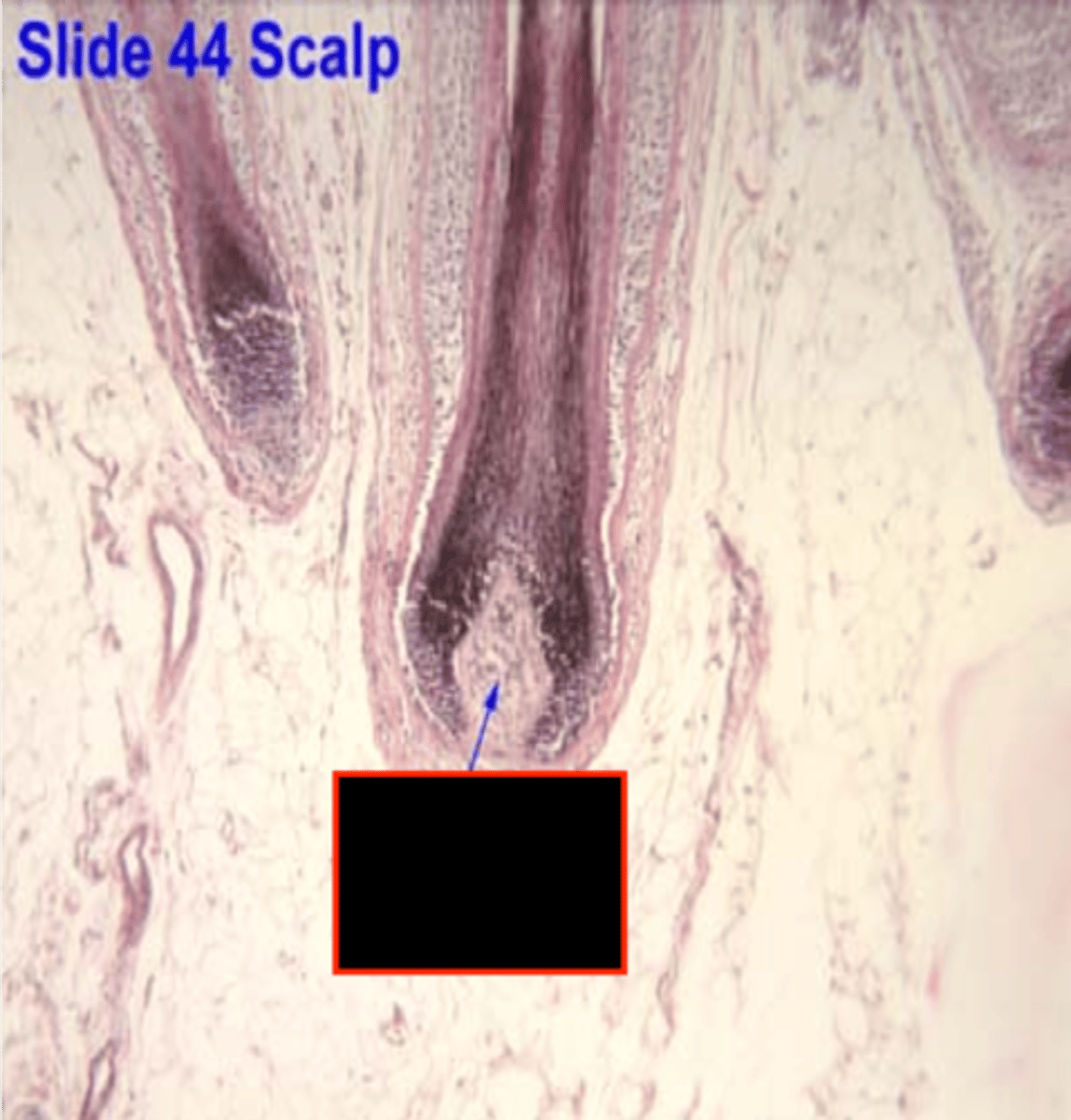 <p>bud of vascular connective tissue encased by bulb, only source of nutrition for hair</p>