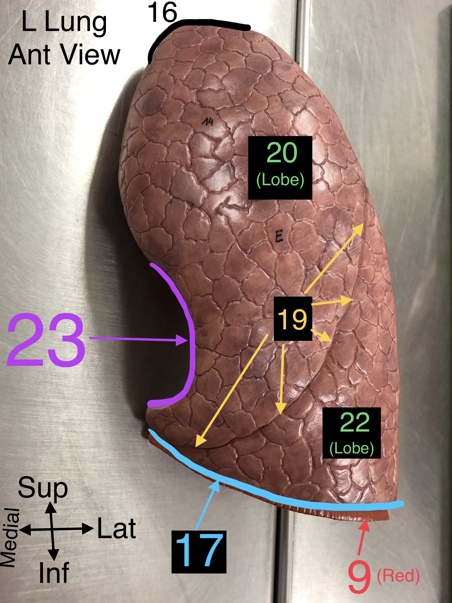 <p>23. A notch in the left lung where the heart accommodates.</p>