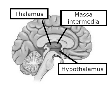 <p>Centraal in brein</p><ul><li><p>midden onder cortex</p></li><li><p>boven hersenstam</p></li></ul><p><strong>Bilaterale</strong> structuur</p><ul><li><p>verbonden door massa intermedia</p></li></ul><p>Ideaal voor connectie met basale ganglia, ruggenmerg, cortex, subcorticale structuren…</p><ul><li><p>ligt in de buurt van alles</p></li></ul>