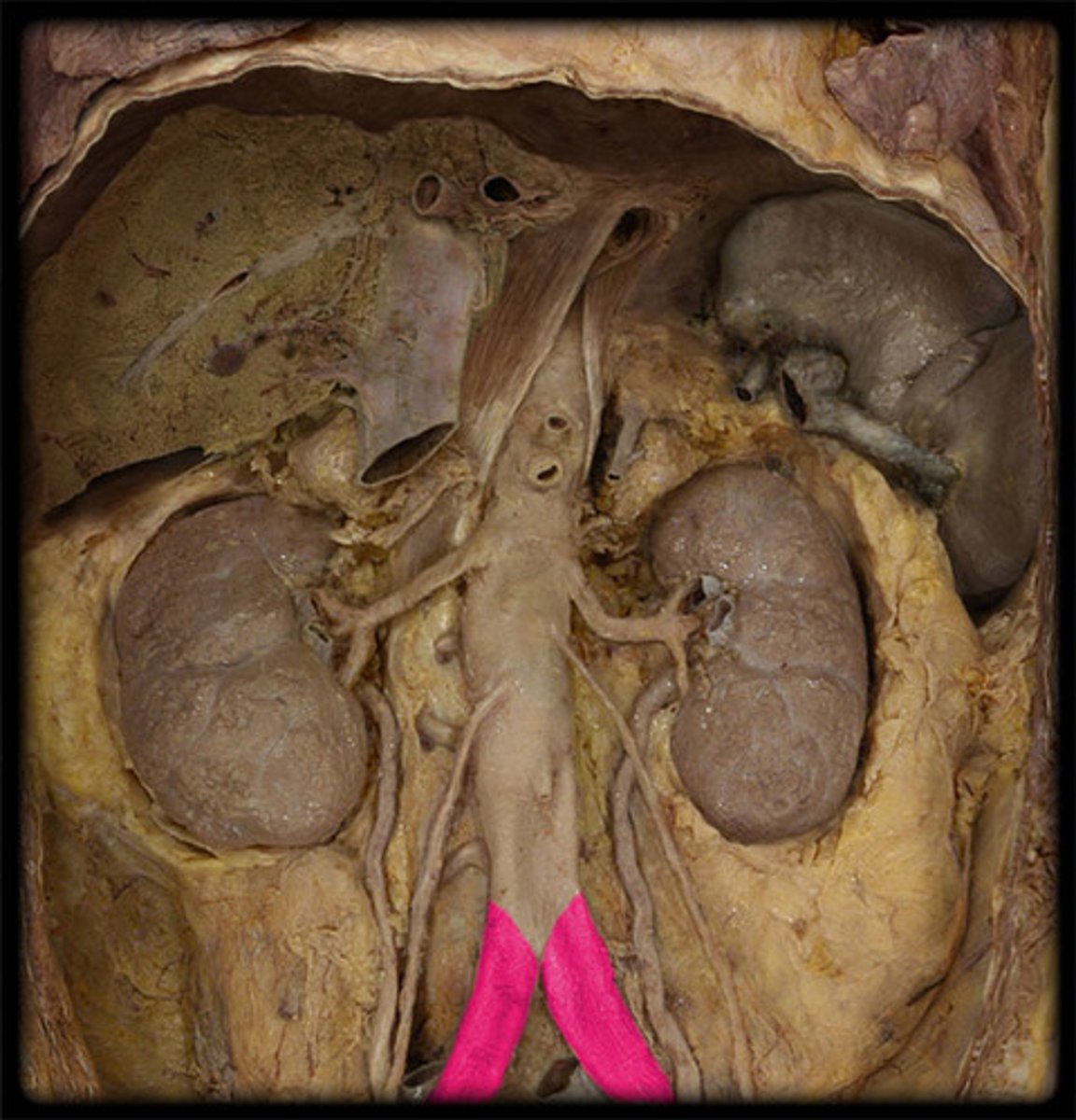 <p>terminal branches of the abdominal aorta</p>
