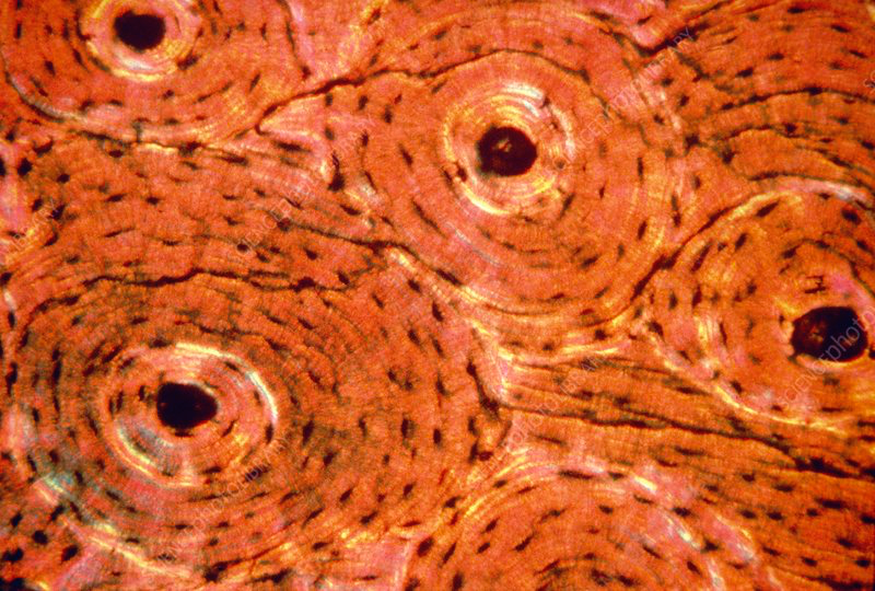 <p>What type of connective tissue is characterized?</p>