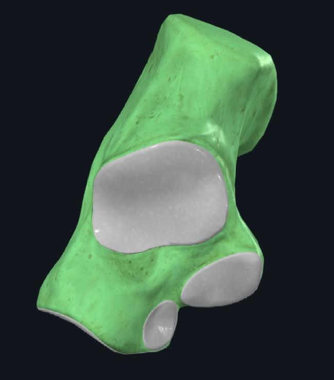 <p>De adelante hacia atrás se encuentra la cara articular anterior para el astrágalo, la cara articular media para el astrágalo y la cara articular posterior para el astrágalo</p>