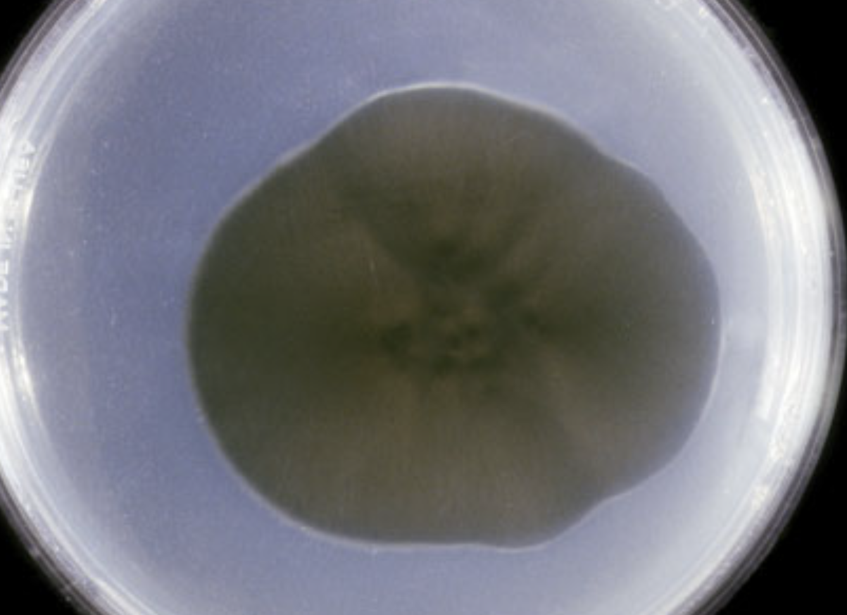 <p>What organism is this? Obverse or reverse?</p>