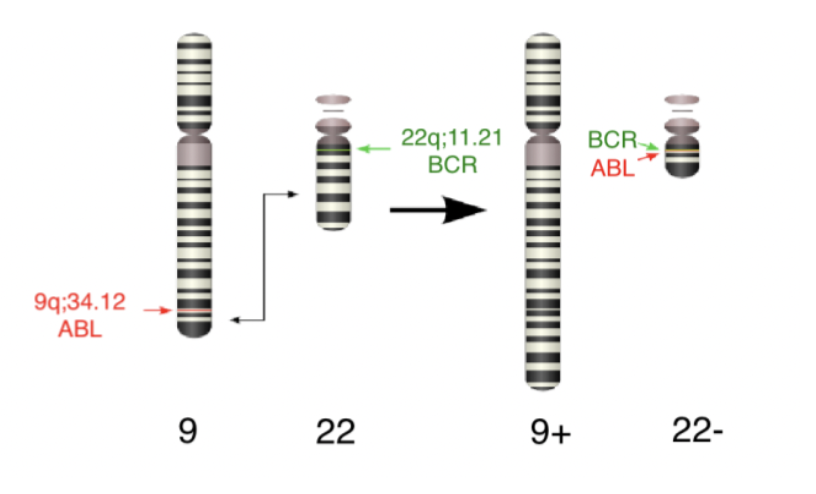 <p>Det uppstår i 95% av alla fall pga translokalisation t(9;22) philadelphiakromosomen → fusionsproteinet <strong>BCR-ABL</strong> uppstår (tyrosinkinasaktivitet). Det är ett protein med tyrosinkinas-aktivitet.</p><p>Det sker <strong>kraftig granulopoes</strong> samtidigt som mognaden inte sker fullständigt. Ofta övergår det till AML inom 3-4 år.</p><p>Behandling är tyrosinkinashämmare, allogen SCT och benmärgsupression.</p>