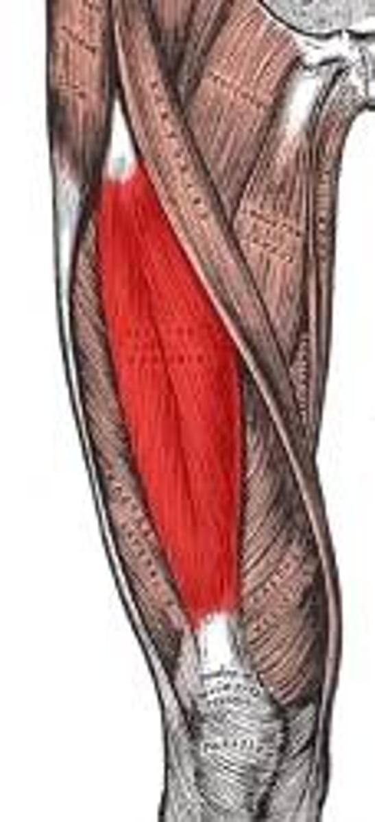 <p>flexes thigh, extends leg</p>