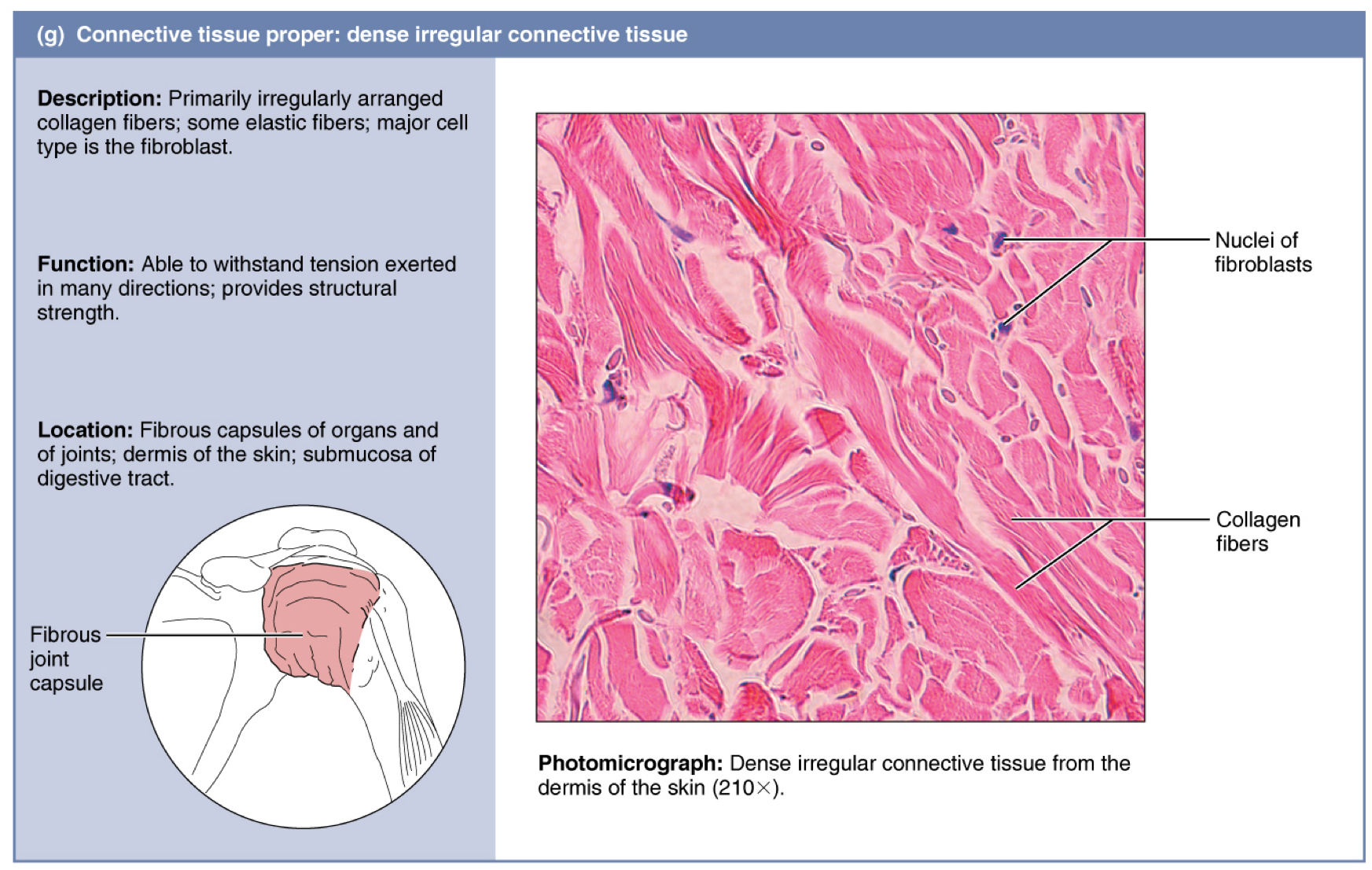 <p>denso irregular</p>
