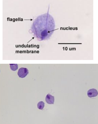 <p>MOT: Sexual intercourse</p><p>Infective Stage: Trophozoite (no cyst form)</p><p>Hosts: Humans</p><p>Parts to look for: Pear-shaped, undulating membrane, flagella, & the axostyle</p>