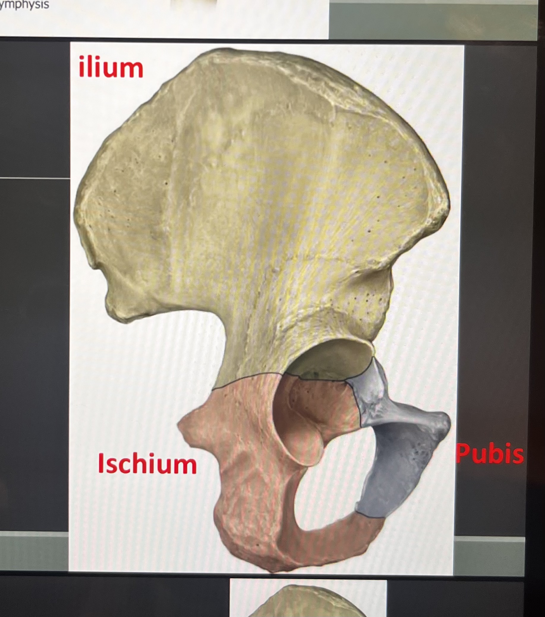 <p>full bone: os coxae </p><p>tan: ilium </p><p>red: ischium</p><p>blue: pubis </p>