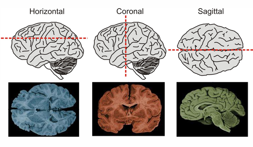 <ul><li><p><strong>Horizontal Plane:</strong> Divides the brain into top and bottom halves.</p></li><li><p><strong>Coronal Plane:</strong> Divides the brain into front and back.</p></li><li><p><strong>Sagittal Plane:</strong> Divides the brain into left and right sides.</p></li></ul><p></p>