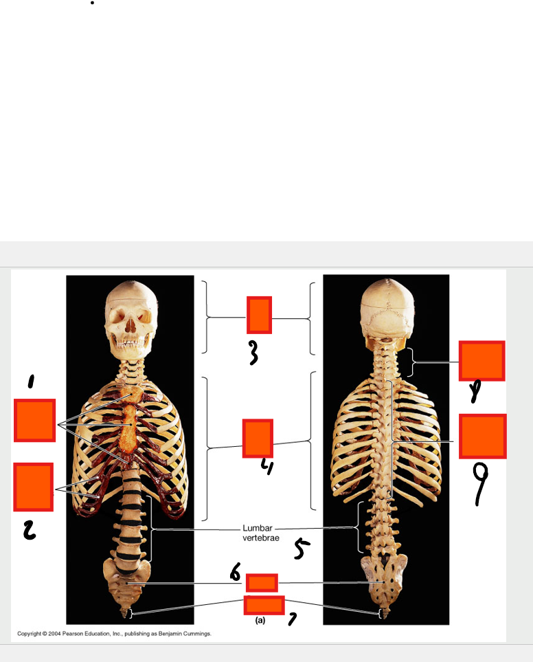 <p>lumbar vertebrae</p>