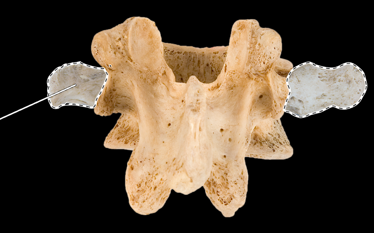 <p>What part of the vertebra is highlighted?</p><p>What type of vertebra is this (which region is this vertebra from)?</p><p>(Posterior view).</p>