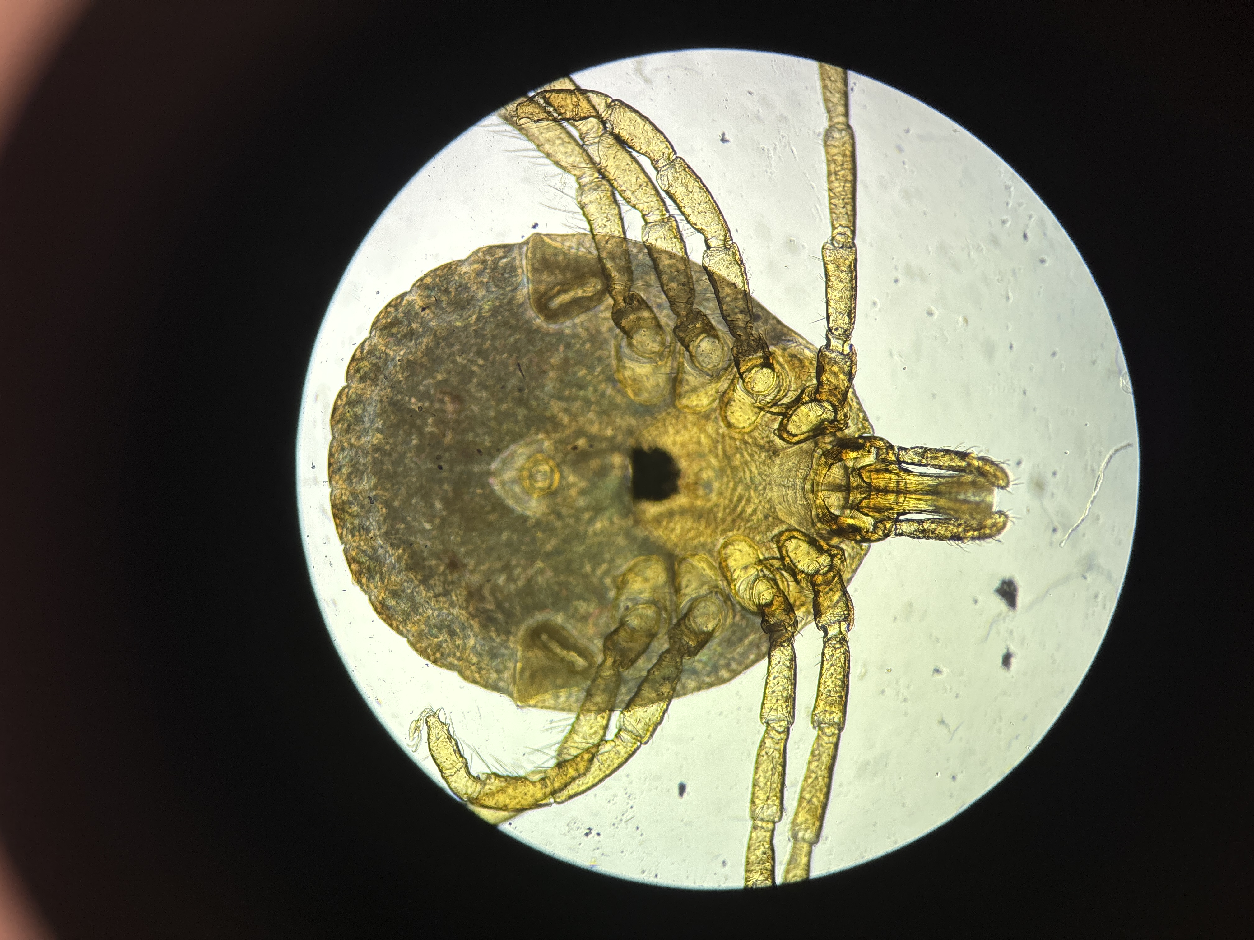 <p>Identify this Tick. (Common and Genus)</p>