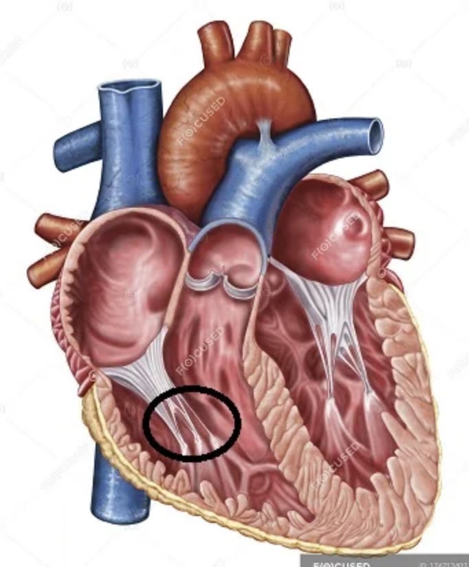 <p>The thin structures inside the heart, circled here, are called ____, and are held in place by ____ muscles.</p>
