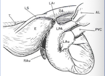<p>vascular ring of aorta, pulmonary artery, &amp; ductus arteriosus</p>