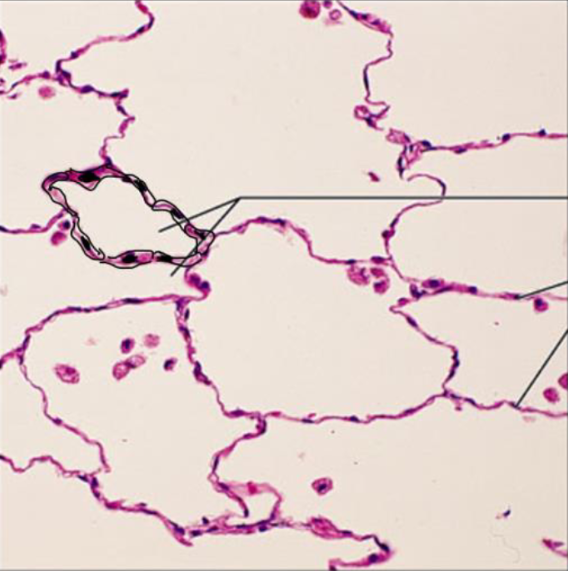 <p>Type of tissue</p>