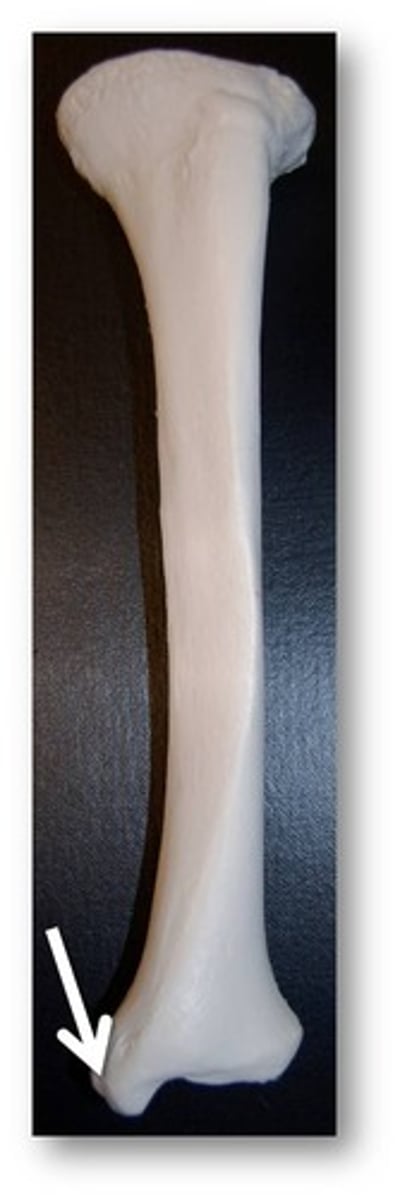 <p>medial process on distal end of tibia, forms medial bump of ankle</p><p>articulates with talus. forming part of ankle joint.</p><p>forms tarsal tunnel with flexor retinaculum (connective tissue band on medial ankle): transition zone (TDAVNH)</p>