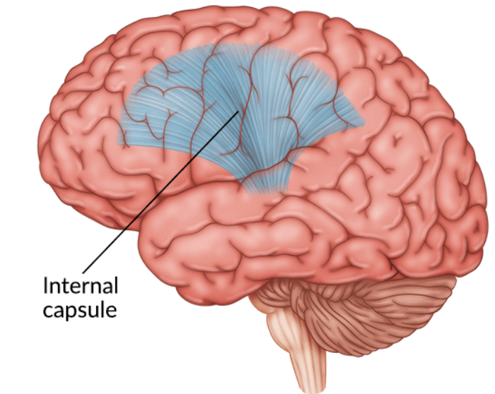 projection fibers- tract of axons from corona radiata that converges into tube

goes through striations of the basal ganglia
