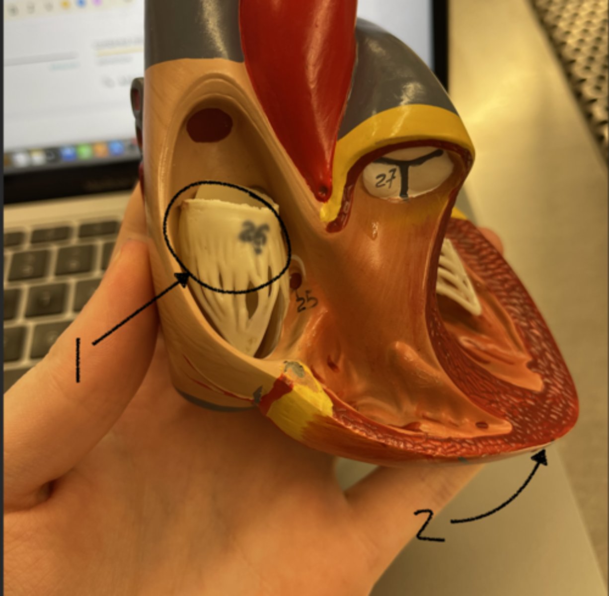 <p>what is structure 2</p>