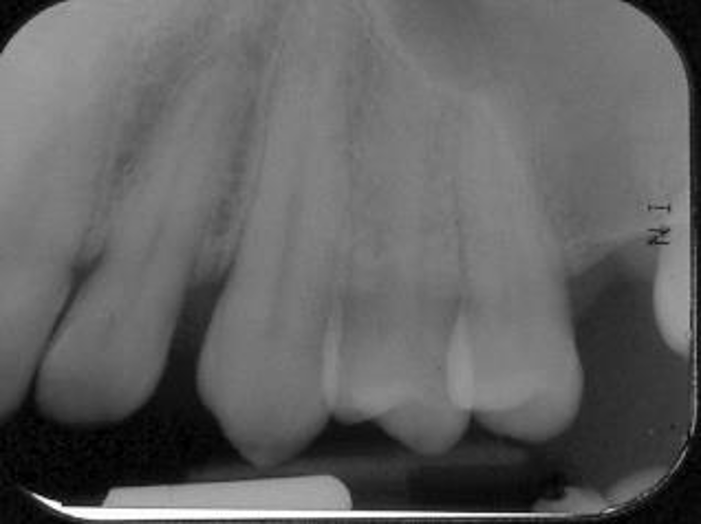 <p>What is this error?</p>